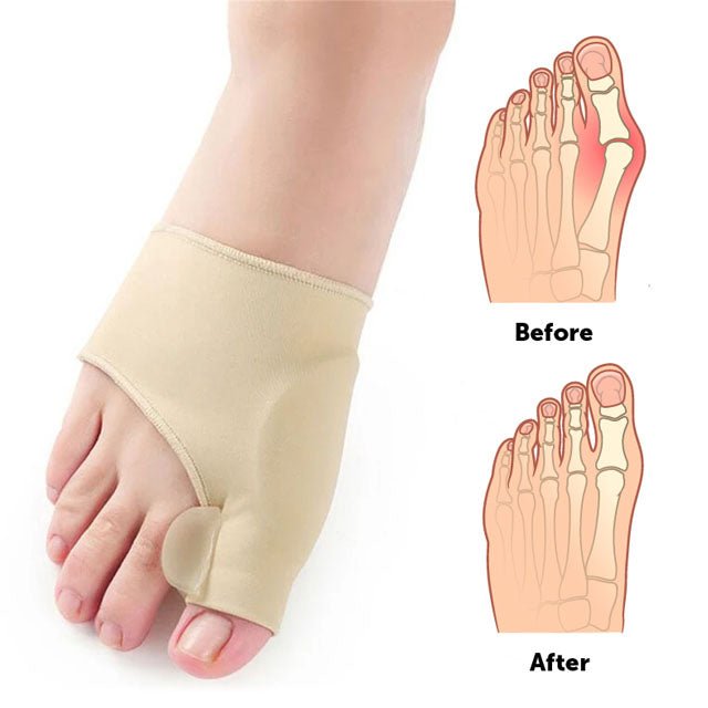 Bunion Corrector - Austier